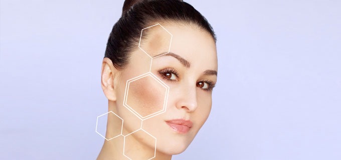 Leke mezoterapisi görseli